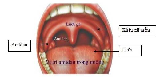 cắt amidan có gây hậu quả gì không