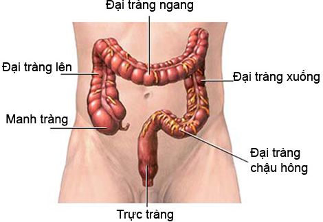 bệnh ung thư đại trực tràng